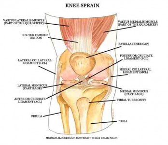 Knee sprain