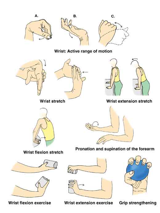 30 Minute Can You Workout With A Sprained Wrist for Build Muscle